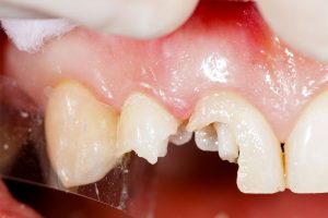 Polaris Dental