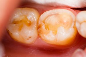 Polaris Dental