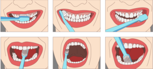 Proper brushing technique for better oral hygiene